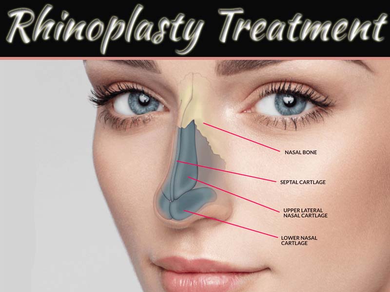 9 Things You Should Know Before A Rhinoplasty Treatment