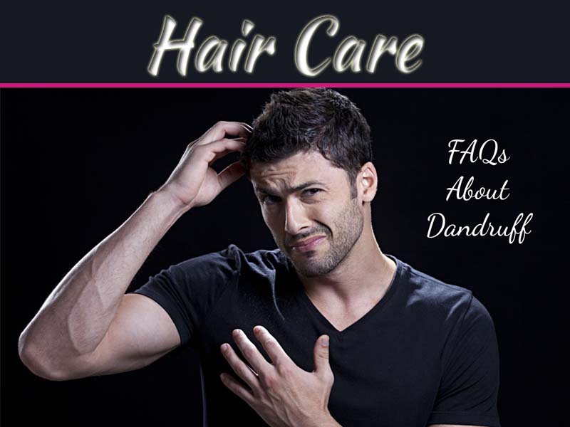 7 Most Frequently Asked Questions About Dandruff
