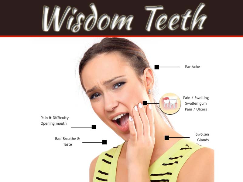 What's The Story Behind The Wisdom Teeth And Why Is It Painful?