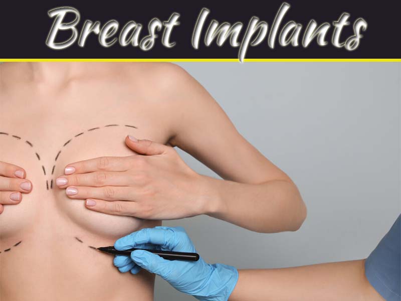 FAQs About Breast Implants