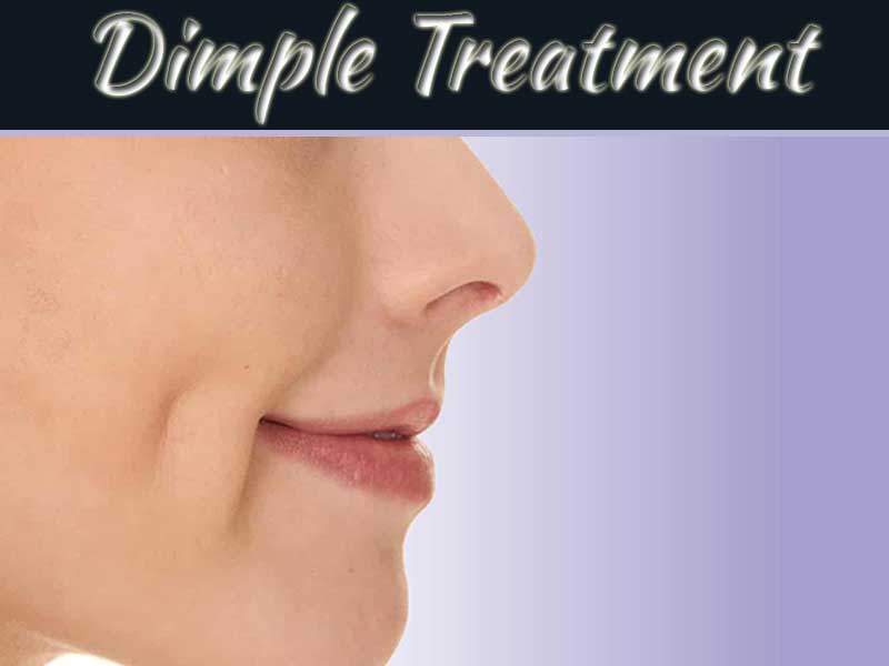 Dimple Treatment
