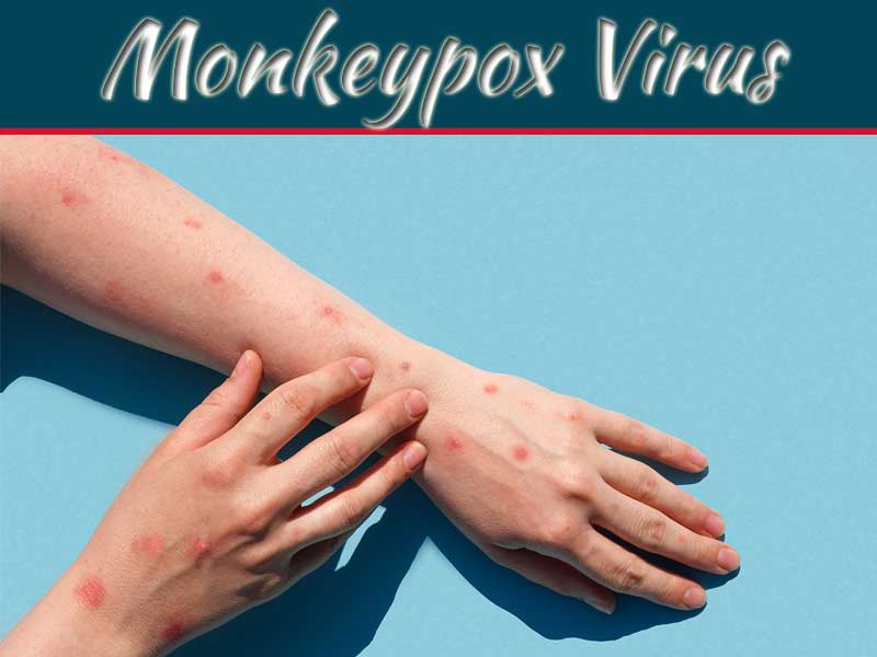 Symptoms Of Monkeypox In Humans & How To Treat It?