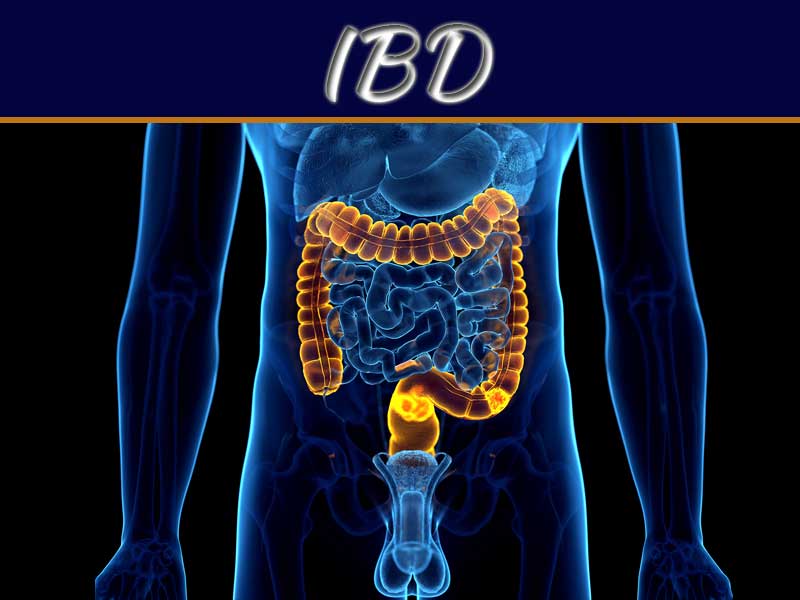 Inflammatory Bowel Disease (IBD) - Symptoms And Causes