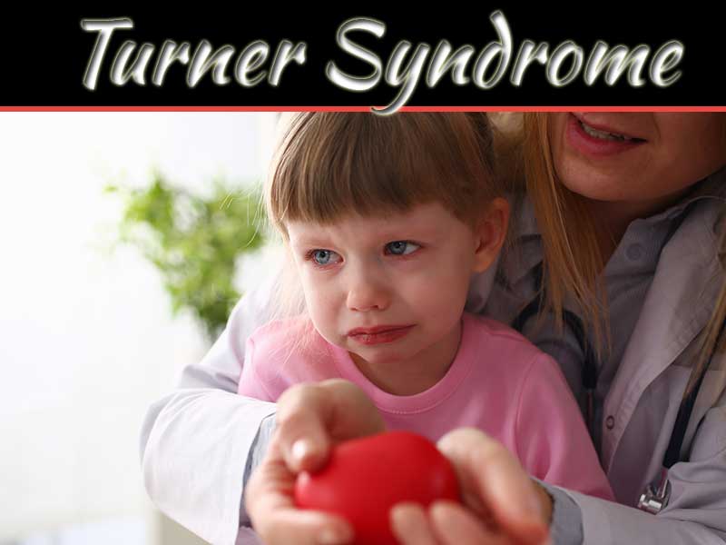 What Causes Turner Syndrome And How To Treat It?